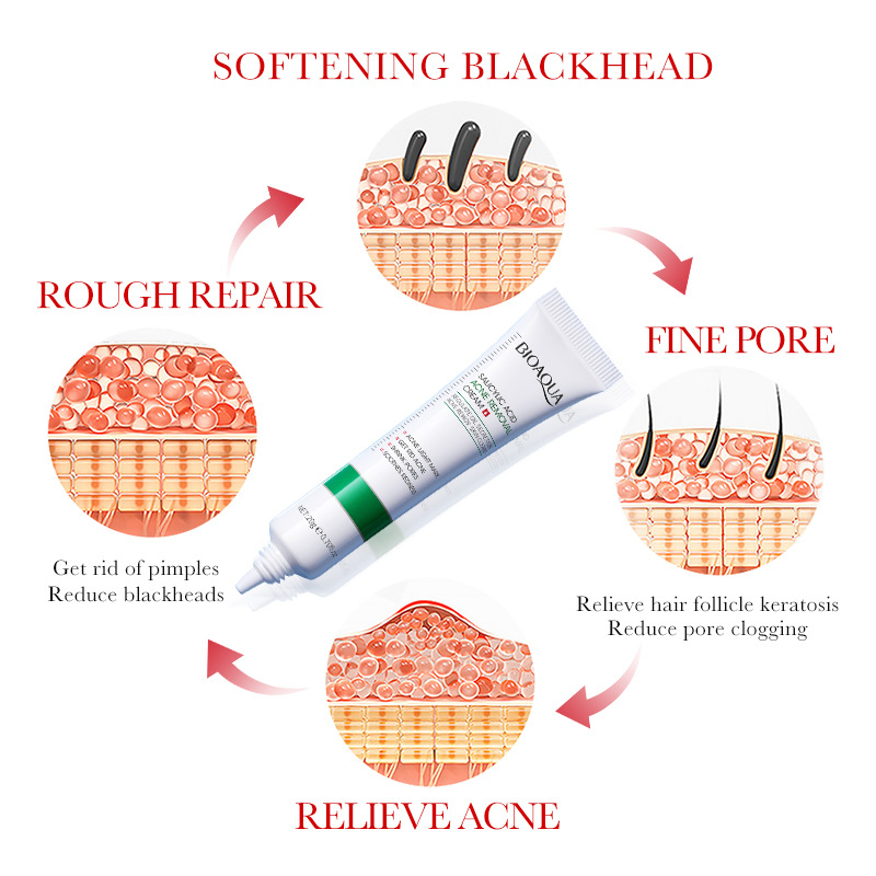 1/2/3 Buah BIOAQUA Krim Wajah  - Salicylic Acid Blackhead Remover ulasan dan harga
