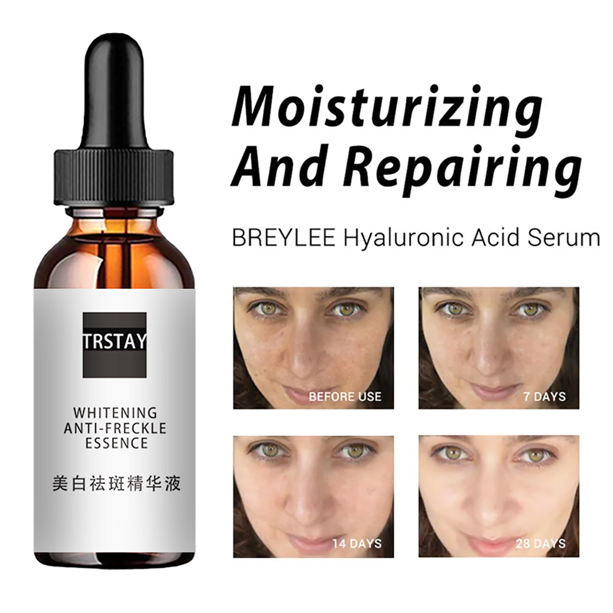 Nicinamide Acid Esens Wajah Pe - Niacinamide Pore Shrinking Essence ulasan dan harga