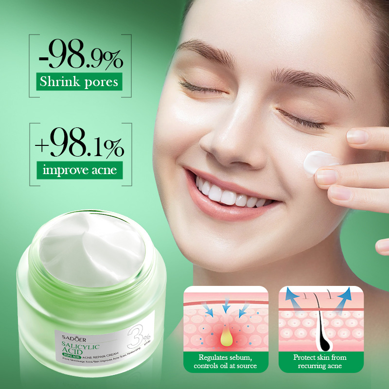 Krim Perawatan Jerawat Asam Sa - Salicylic Acid Blackhead Remover ulasan dan harga