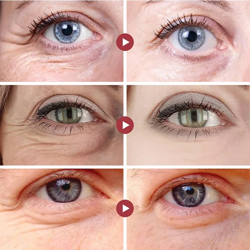 Patch Penghilang Kerutan Mata  - Collagen Under Eye Patches ulasan dan harga